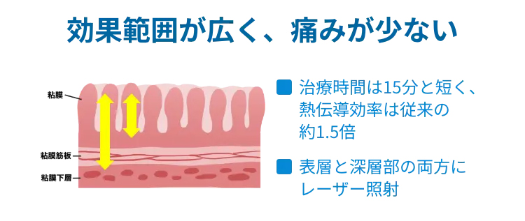 スノアレーズ治療